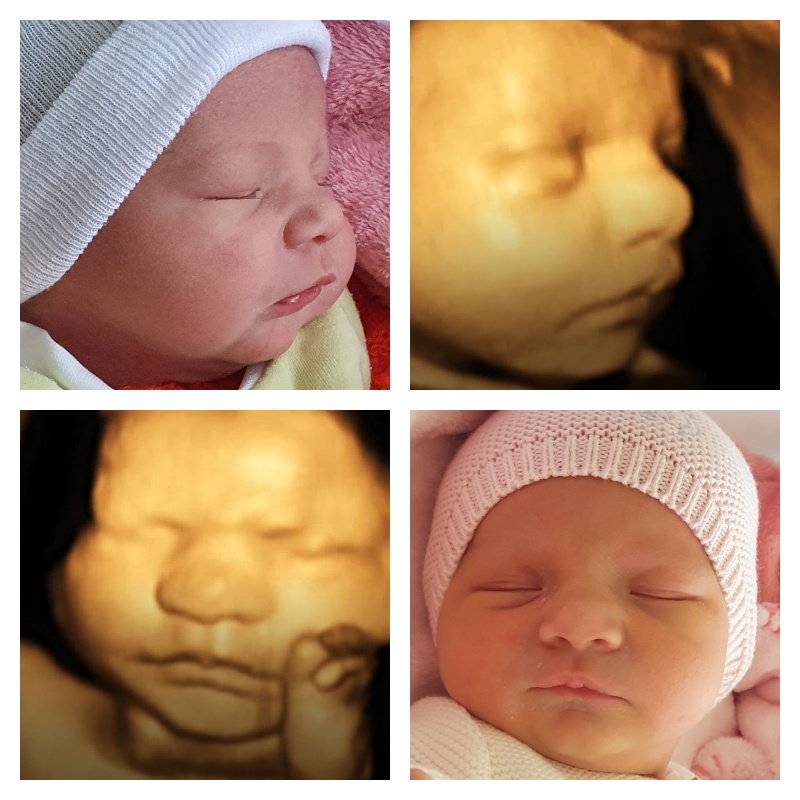 Babycocoon 3d Institut D Echographie 3d Prenatale A Gland
